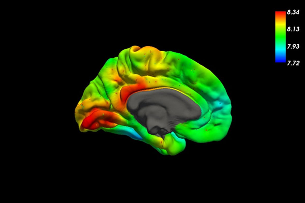 Die Dysfunktion der BlutHirnSchranke Schlüsselschritt bei